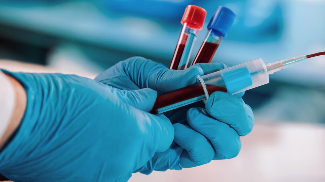 Colorectal cancer screening guidelines updated to include blood test for the first time