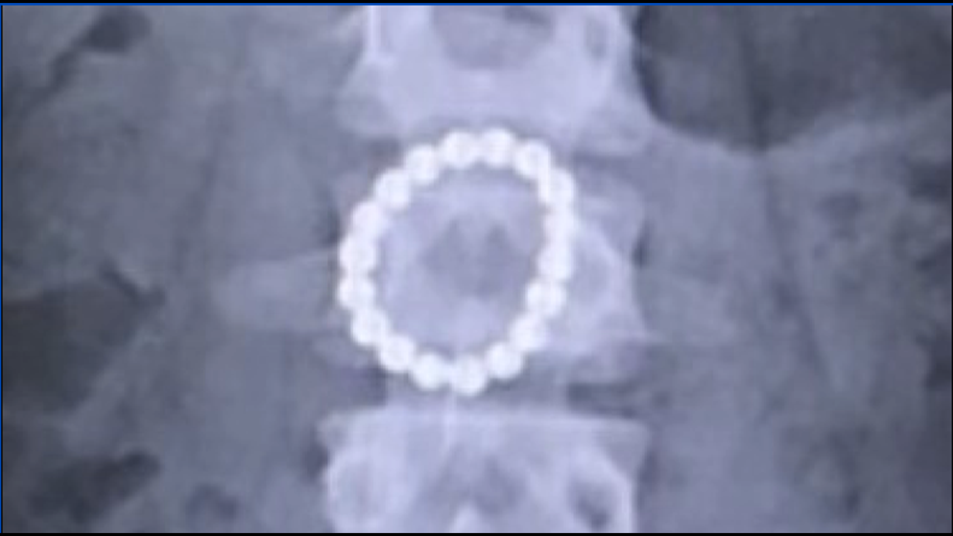 Doctors warn that children are swallowing high-powered rare earth magnet balls marketed as desk toys for adults – sending thousands of kids to the hospital.