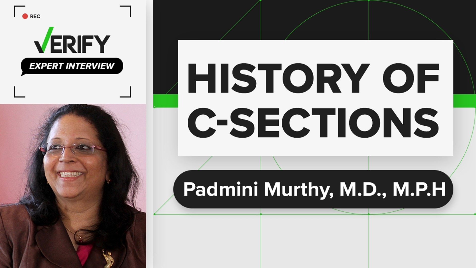 Padmini Murthy, M.D., M.P.H., explains the origin of C-section surgeries.