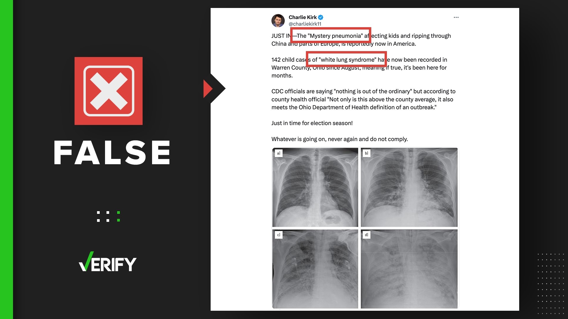 Posts falsely claim a new and mysterious respiratory illness called white lung syndrome is spreading in China and the U.S. Here are the facts.