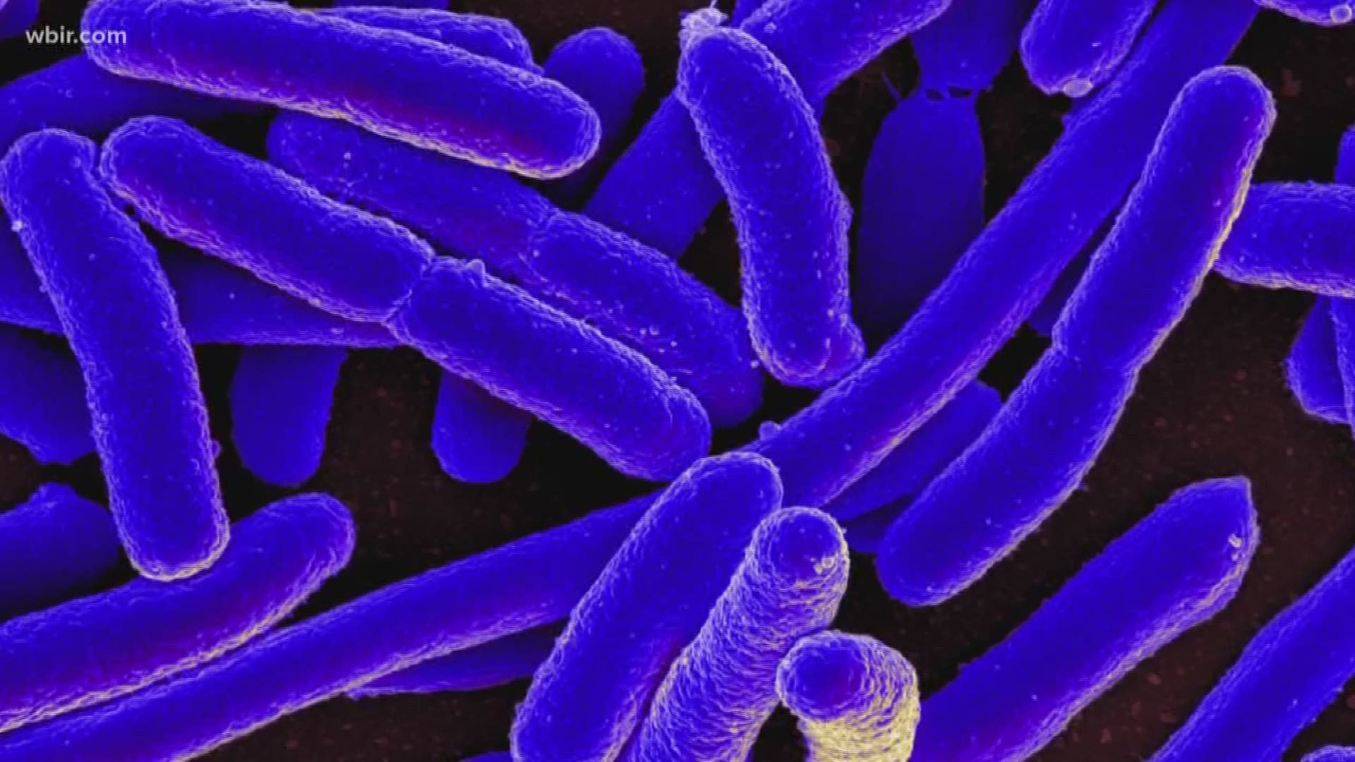 East Tennessee Children's Hospital says it's treating the biggest E. coli outbreak the hospital has seen in decades. The Knox Co. Health Department is investigating what caused the cases. June 5, 2018.