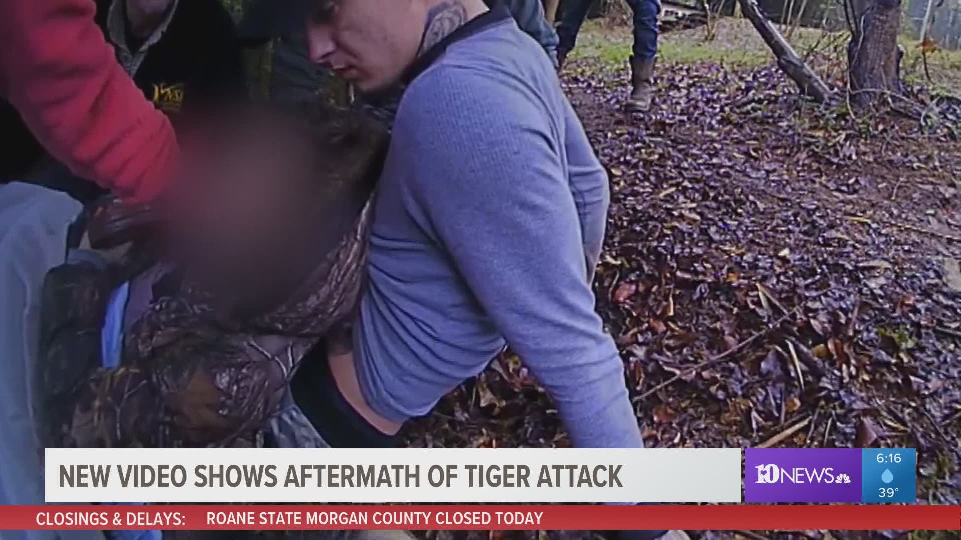 New video shows aftermath of tiger attack that nearly ripped off  18-year-old's arm 