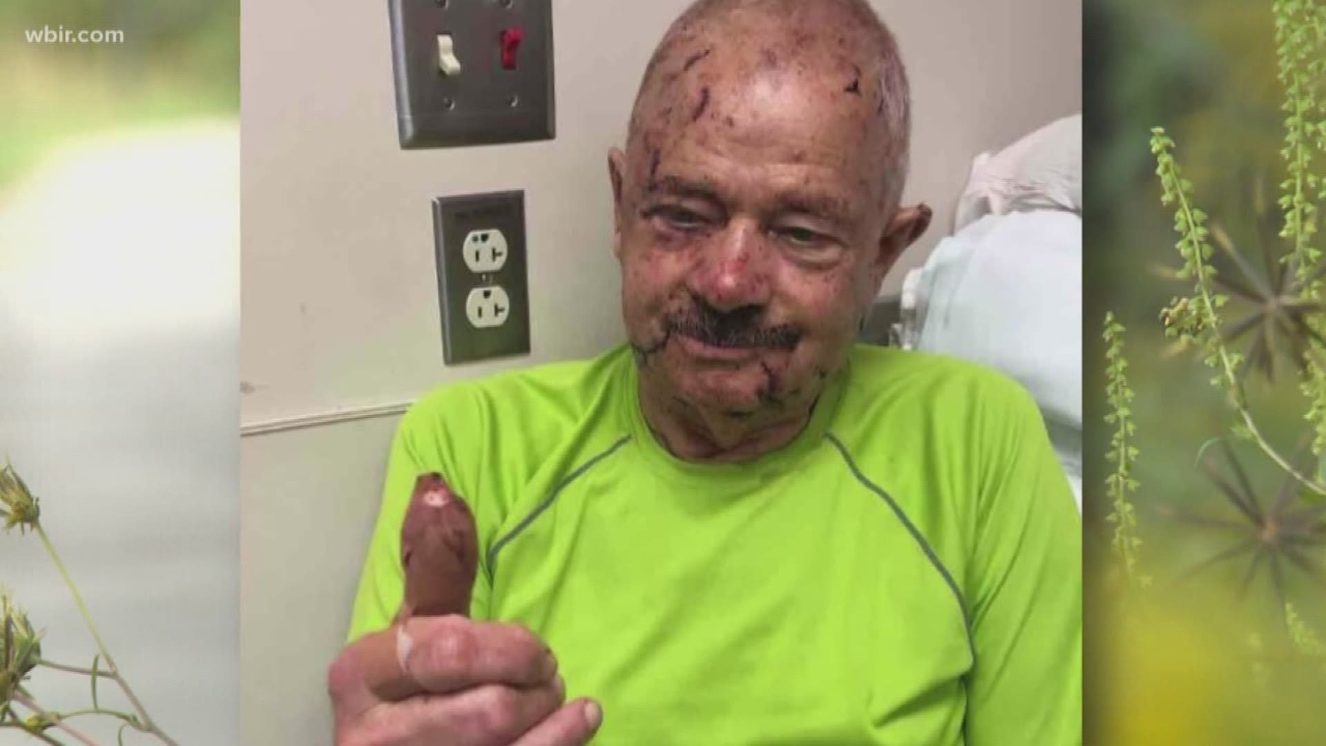 A runner is urging people to be more careful on the greenways in Knoxville after he found a man who was attacked on a trail.