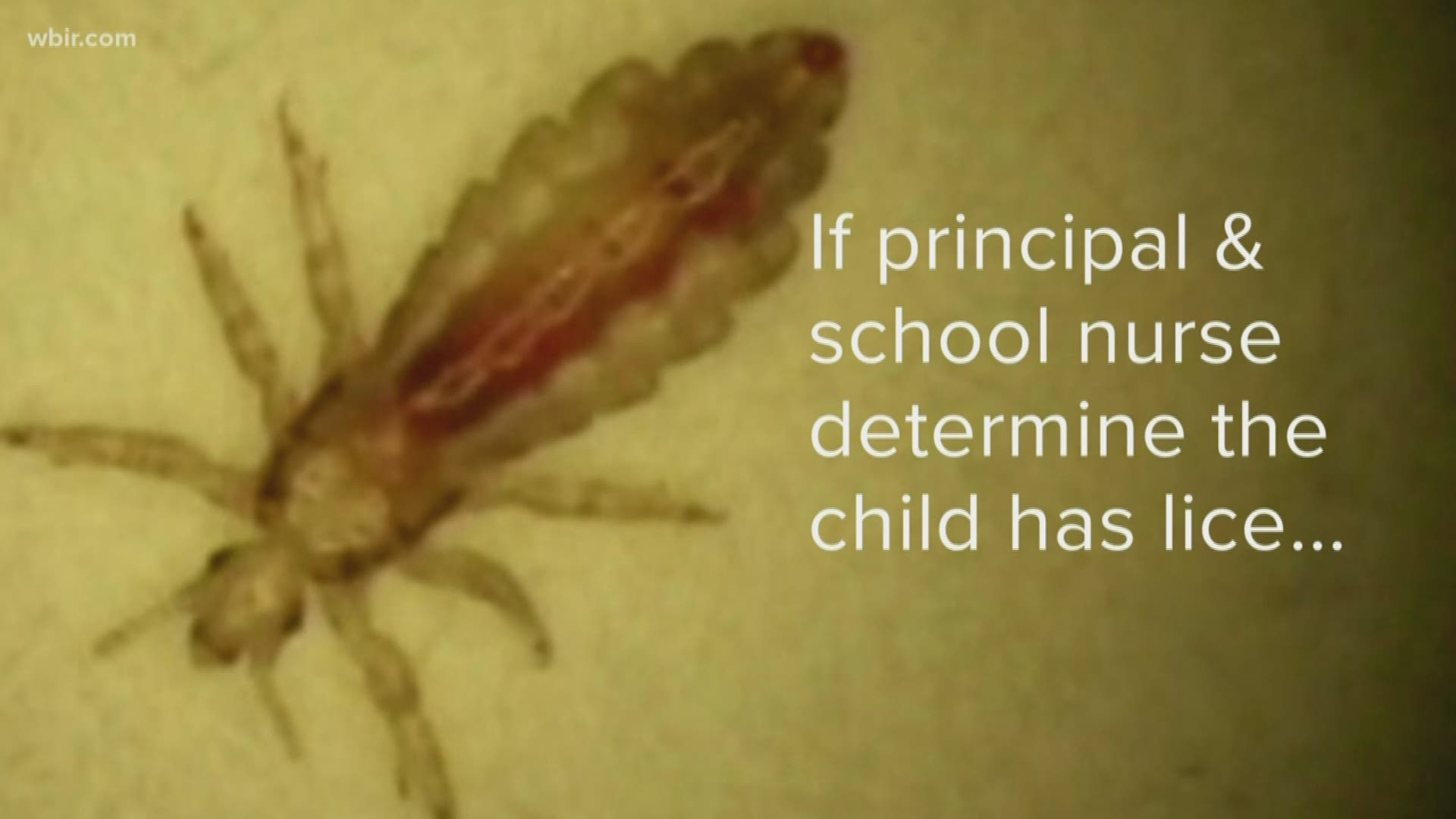 Parents in Roane County are upset with the school system's lice policy--saying kids aren't being sent home when they have an infestation.