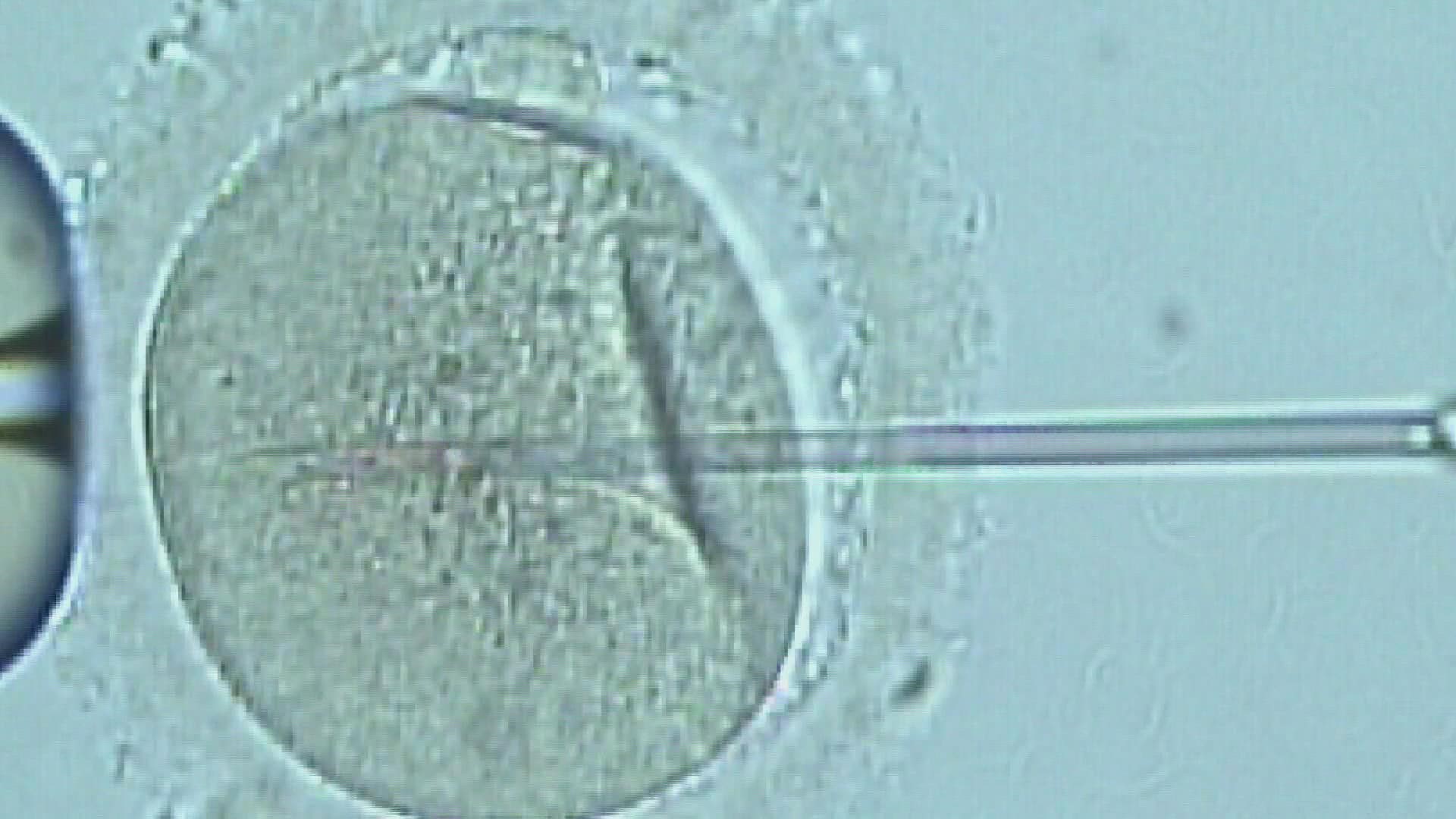 IVF is a procedure meant to help make a woman pregnant and could involve making several embryos. However, states can pass laws saying life begins at conception.
