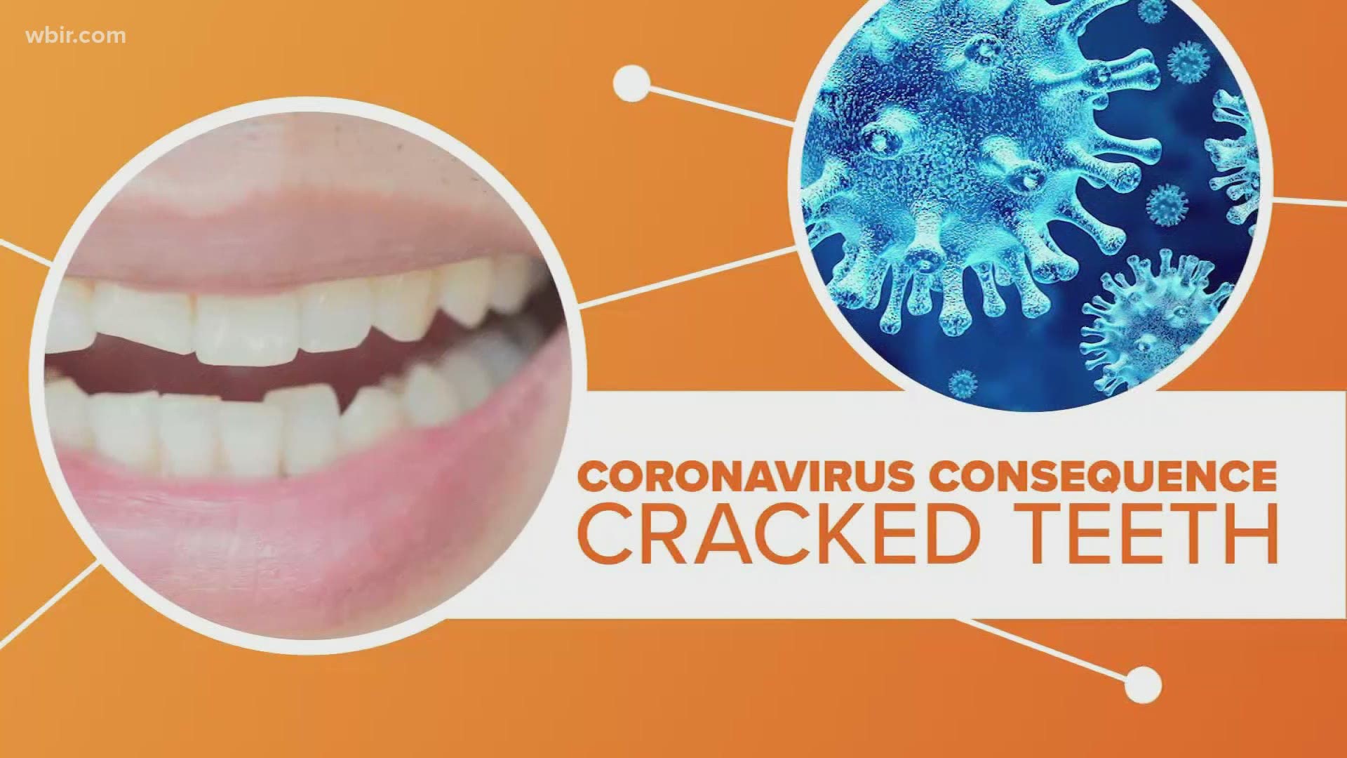 We are seeing some strange consequences from the coronavirus pandemic and that apparently includes more cracked teeth.