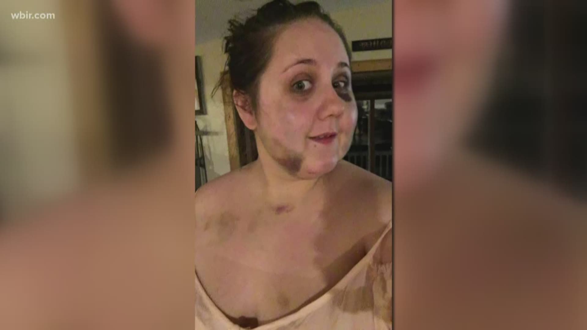 A Sevierville woman is speaking out after suffering what she says were years of physical and mental abuse from her husband.