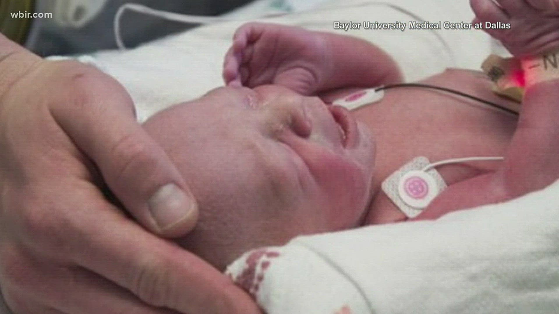 Baby Born in U.S. after Uterus Transplant