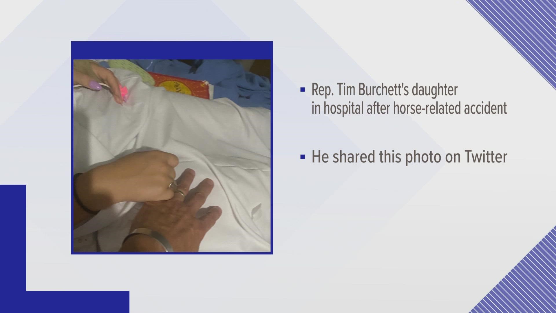 U.S. Representative Tim Burchett of Knoxville is asking for thoughts and prayers after his daughter was injured in a horse-related accident on Friday.