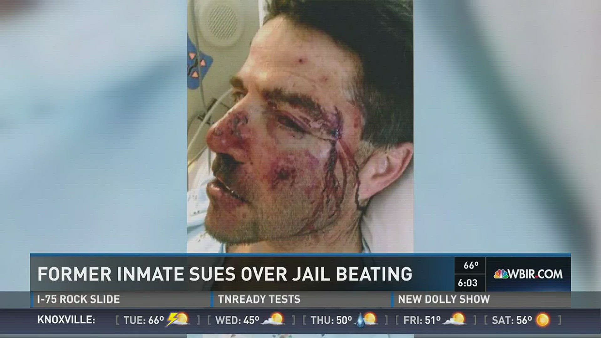 A former inmate is suing Hamblen County for $ 5 million , saying another inmate beat him while he slept.