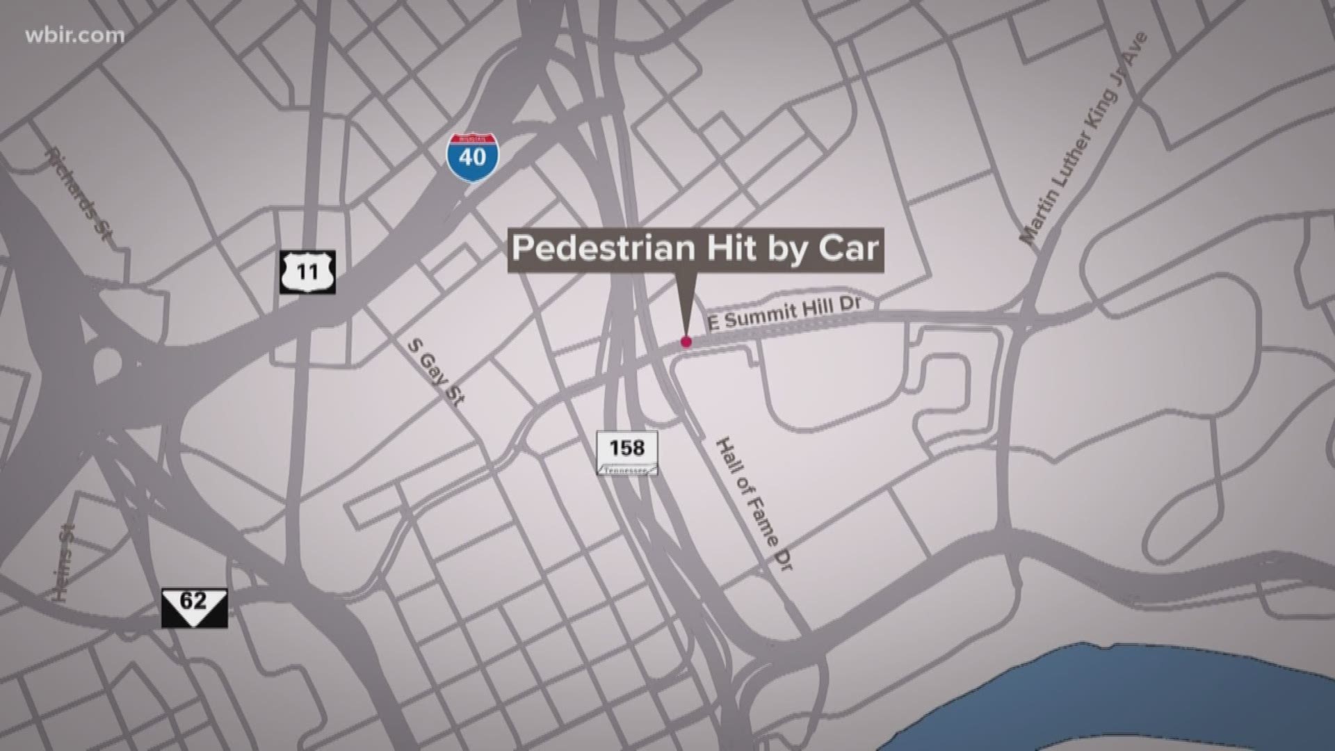 One person is in the hospital after being hit by a car Monday morning.