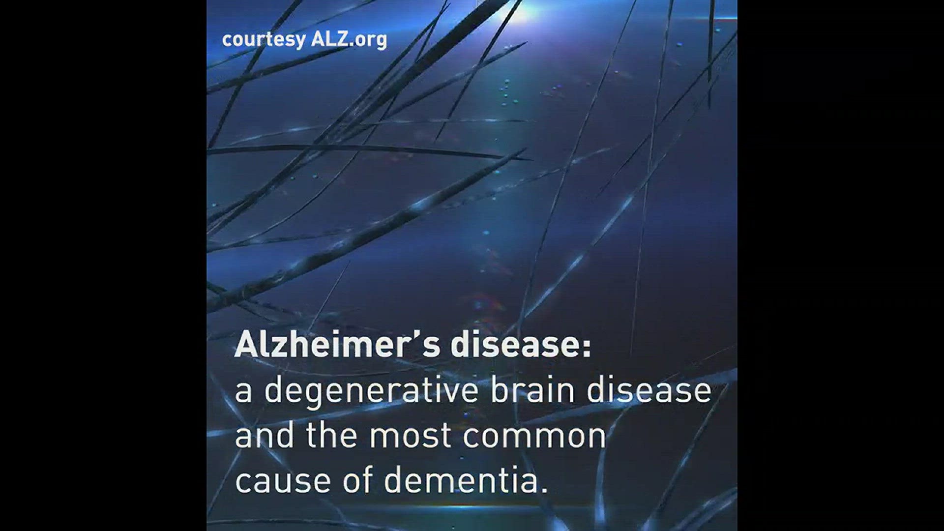 Alzheimer's disease is a degenerative brain disease and the most common cause of dementia, the Alz.org report states.