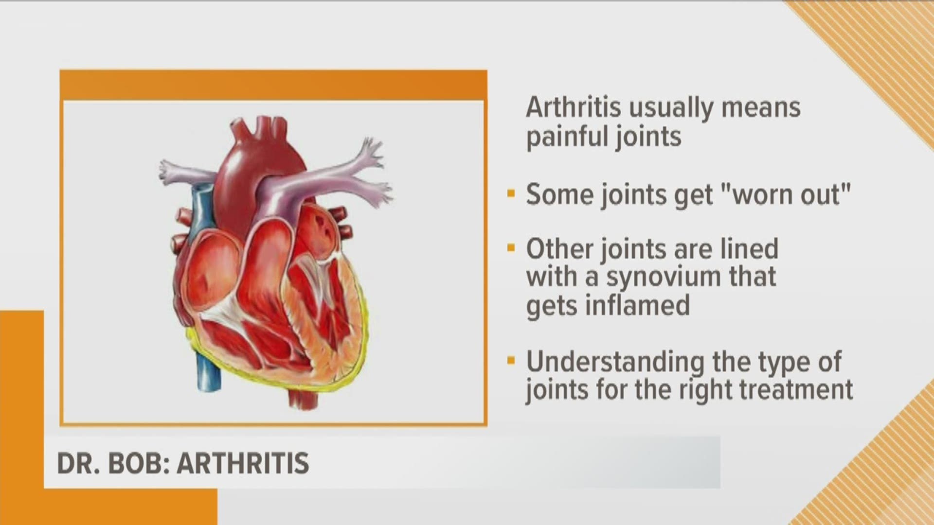 Dr. Bob explains the various types of arthritis people experience and what you should do if you have it.