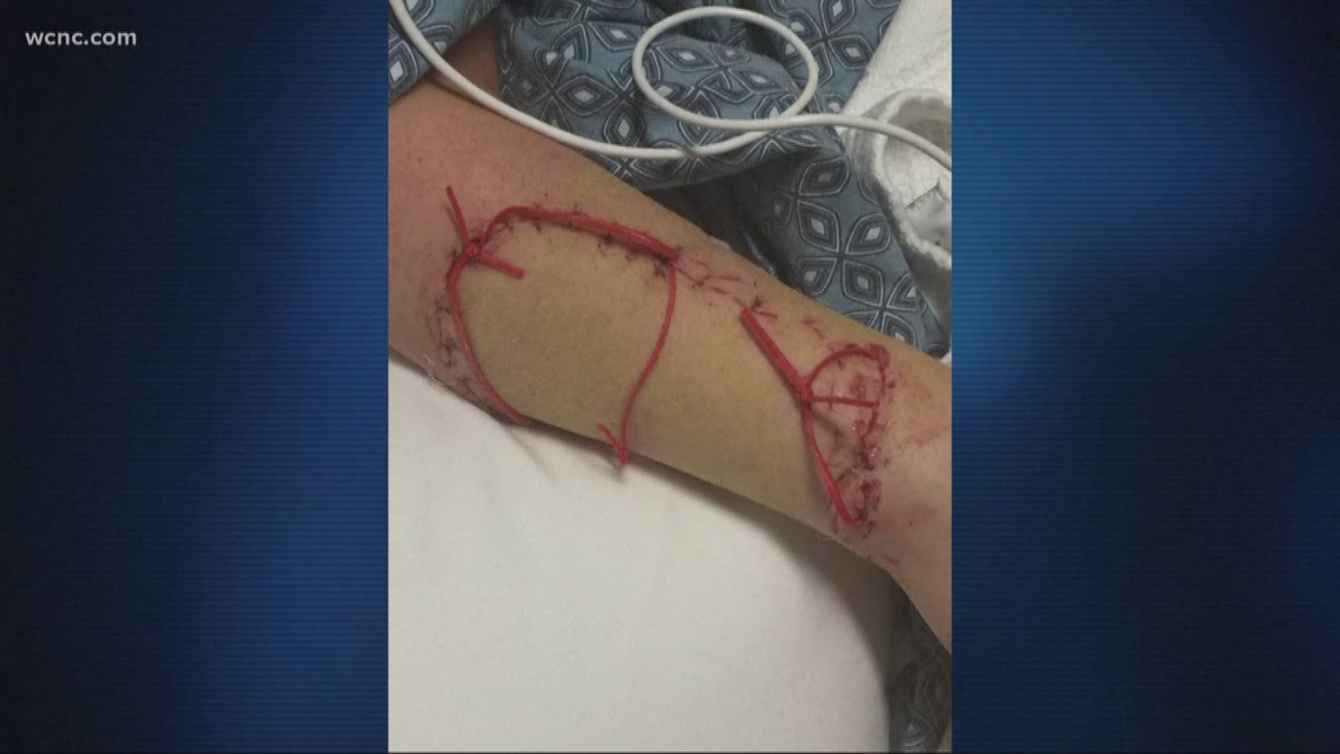 Brit fisherman, 30, savaged by shark in horror attack that ripped open 3 of  his arteries after hooking it on his line |, image size:1920x1080